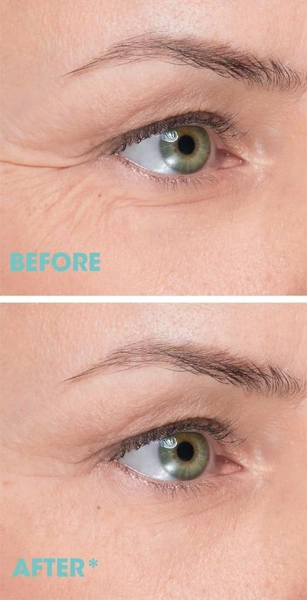 Remescar Kraaienpootjes - 8ml 7 Remescar Kraaienpootjes - 8ml - Afbeelding 5