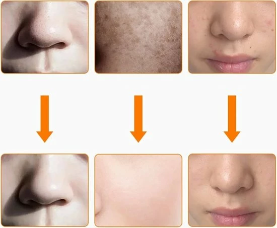 Merkloos LED Gezichtsmaker - 7 Kleuren - Face Mask - Lichttherapie - Masker Voor Gezicht - Tegen Acne, Droge Huid & Rimpels - Wit 4 Merkloos LED Gezichtsmaker - 7 Kleuren - Face Mask - Lichttherapie - Masker Voor Gezicht - Tegen Acne, Droge Huid & Rimpels - Wit - Afbeelding 2