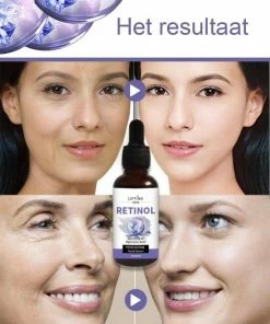 M?OYAM M OYAM Active Retinol Serum - Inclusief Dermaroller - Vitamine E & Hyaluronzuur - Gezichtsserum - Anti Aging - Celvernieuwing - Anti-Acne - Tegen Mee-eters En Grove Pori N - Tegen Pigmentvlekken - 30ML -Maybelline-winkel 550x675 2